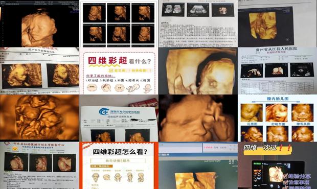 汕头怀孕几个月做四维彩超*佳