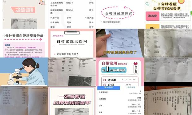 汕头白带常规检查怎么做