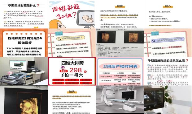 汕头做四维彩超价格表