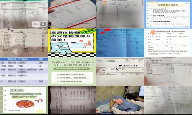 汕头支原体如何检查