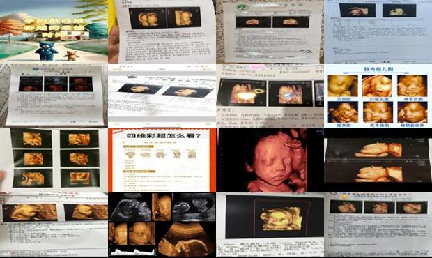 汕头怀孕多久做四维