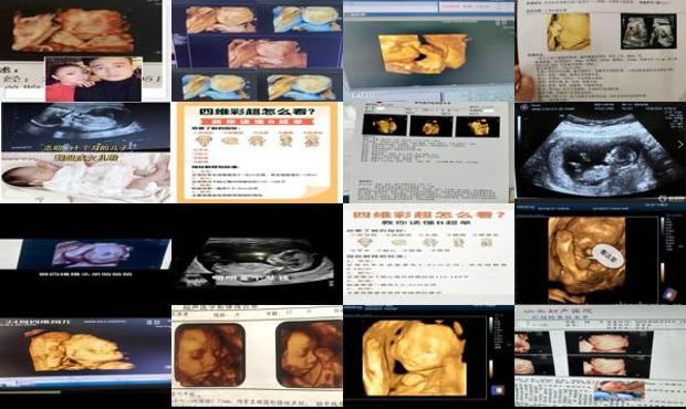 汕头四维看男孩女孩诀窍