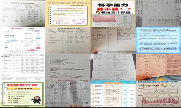 汕头女性雌激素六项检查
