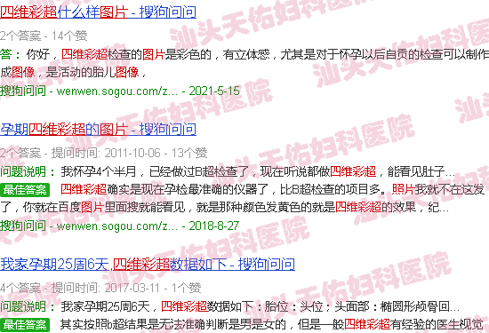 汕头四维彩超图片图