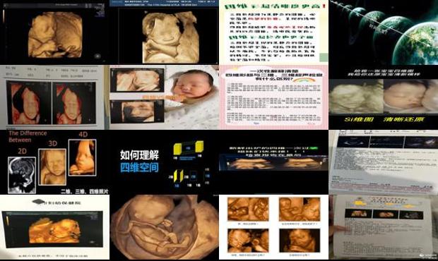 汕头四维和三维有什么区别