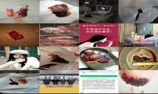 汕头怀孕流产