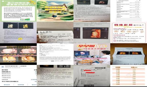 汕头四维费用多少钱