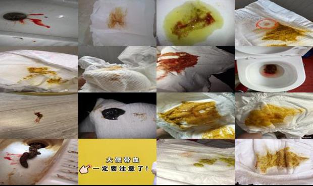 汕头做月子大便有血
