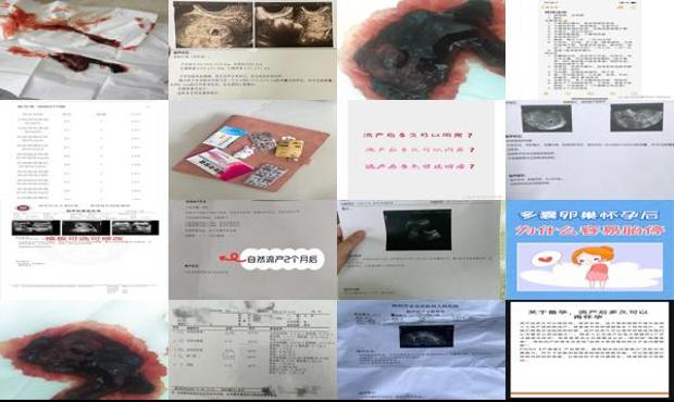 汕头自然流产后多久可以再怀孕